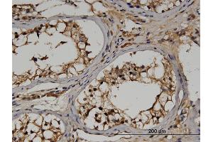Immunoperoxidase of monoclonal antibody to RGS14 on formalin-fixed paraffin-embedded human testis. (RGS14 抗体  (AA 1-566))