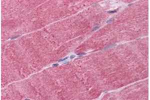 Human Skeletal muscle: Formalin-Fixed, Paraffin-Embedded (FFPE) (WDR77 抗体  (AA 1-343))