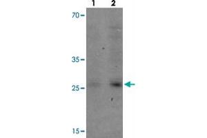 Western blot analysis of VNN3 in human brain tissue with VNN3 polyclonal antibody  at (1) 0. (VNN3 抗体  (C-Term))