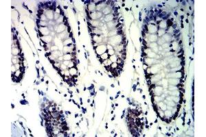Immunohistochemistry (IHC) image for anti-MutS Homolog 6 (E. Coli) (MSH6) (AA 374-540) antibody (ABIN7193706)