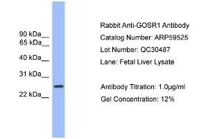 WB Suggested Anti-GOSR1  Antibody Titration: 0. (GS28 抗体  (C-Term))