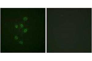 Immunofluorescence analysis of A549 cells, using HDAC3 (Phospho-Ser424) Antibody. (HDAC3 抗体  (pSer424))