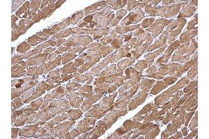 IHC-P Image alpha Cardiac Muscle Actin antibody detects alpha Cardiac Muscle Actin protein at cytoplasm on mouse heart by immunohistochemical analysis. (ACTC1 抗体)