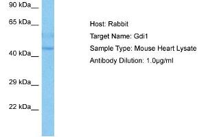 Host:  Mouse  Target Name:  GDI1  Sample Tissue:  Mouse Heart  Antibody Dilution:  1ug/ml (GDI1 抗体  (C-Term))