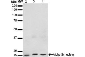 Western Blot analysis of Human, Mouse, Rat Brain showing detection of 14 kDa Alpha Synuclein protein using Mouse Anti-Alpha Synuclein Monoclonal Antibody, Clone 3F8 (ABIN5564089). (SNCA 抗体)