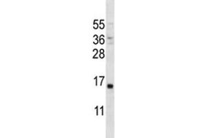 PTH antibody western blot analysis in MDA-MB231 lysate. (PTH 抗体  (AA 59-88))