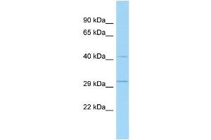 WB Suggested Anti-Tsc22d4 Antibody Titration: 1. (TSC22D4 抗体  (N-Term))