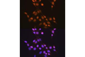 Immunofluorescence analysis of NIH-3T3 cells using CTCF antibody (ABIN7266164). (CTCF 抗体)
