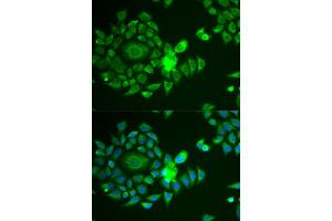 Immunofluorescence analysis of U2OS cells using NDUFS4 antibody. (NDUFS4 抗体)
