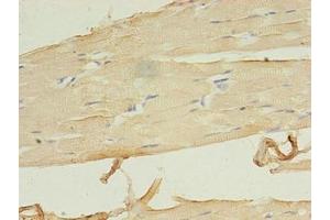 Immunohistochemistry of paraffin-embedded human skeletal muscle tissue using ABIN7158082 at dilution of 1:100 (LRRN1 抗体  (AA 26-631))