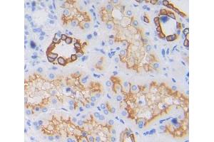 Immunohistochemistry (IHC) image for anti-Protein tyrosine Phosphatase, Receptor Type, A (PTPRA) (AA 624-800) antibody (ABIN5014196)
