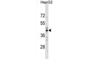 Western Blotting (WB) image for anti-RNA (Guanine-9-) Methyltransferase Domain Containing 2 (RG9MTD2) antibody (ABIN2999749) (RG9MTD2 抗体)