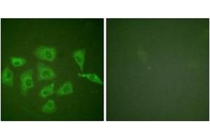Immunofluorescence analysis of HuvEc cells, using Trk A (Ab-791) Antibody. (TRKA 抗体  (AA 747-796))