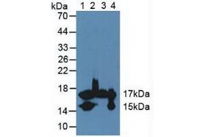 Figure. (FABP4 抗体  (AA 2-132))