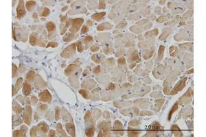 Image no. 1 for anti-Acyl-CoA Dehydrogenase, Very Long Chain (ACADVL) (AA 345-435) antibody (ABIN598520) (ACADVL 抗体  (AA 345-435))