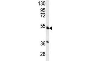 Western blot analysis of HNF4A antibody and NCI-H460 lysate. (HNF4A 抗体  (AA 118-146))