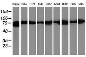 Image no. 2 for anti-Catenin (Cadherin-Associated Protein), beta 1, 88kDa (CTNNB1) antibody (ABIN1496892) (CTNNB1 抗体)