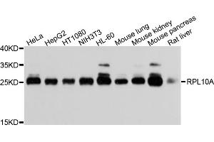 Western blot analysis of extracts of various cell lines, using RPL10A antibody (ABIN5973518) at 1/1000 dilution. (RPL10A 抗体)