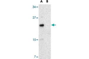 Western blot analysis of NKIRAS2 in Raw 264. (NKIRAS2 抗体  (C-Term))