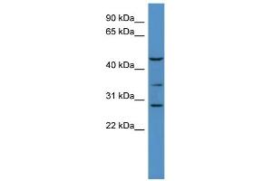 B3GALT2 抗体  (C-Term)