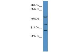 WB Suggested Anti-B3galt2 Antibody Titration:  0. (B3GALT2 抗体  (C-Term))