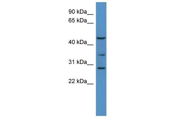 B3GALT2 抗体  (C-Term)