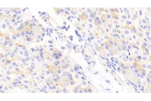 Detection of ABCD2 in Mouse Stomach Tissue using Polyclonal Antibody to ATP Binding Cassette Transporter D2 (ABCD2) (CCL17 抗体  (AA 501-695))