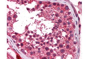 Immunohistochemistry (IHC) image for anti-Telomeric Repeat Binding Factor 2, Interacting Protein (TERF2IP) (AA 142-191) antibody (ABIN6747199)