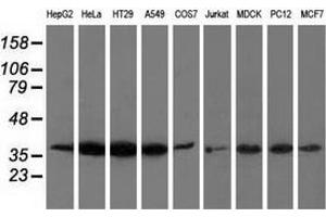 Western blot analysis of extracts (35 µg) from 9 different cell lines by using anti-ANXA3 monoclonal antibody. (Annexin A3 抗体)