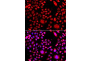 Immunofluorescence analysis of A549 cells using RAC3 antibody (ABIN5975576). (RAC3 抗体)