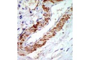 Image no. 1 for anti-Mitogen-Activated Protein Kinase Kinase Kinase 8 (MAP3K8) (C-Term) antibody (ABIN360298) (MAP3K8 抗体  (C-Term))