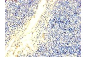 Immunohistochemistry of paraffin-embedded human thymus tissue using ABIN7150213 at dilution of 1:100 (TdT 抗体  (AA 1-509))