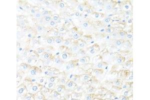 Immunohistochemistry of paraffin-embedded Rat liver using IL7 Polyclonal Antibody at dilution of 1:100 (40x lens). (IL-7 抗体)