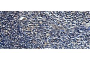 Immunohistochemistry of paraffin-embedded Human tonsil tissue using HAUS6 Polyclonal Antibody at dilution of 1:45(x200) (FAM29A 抗体)