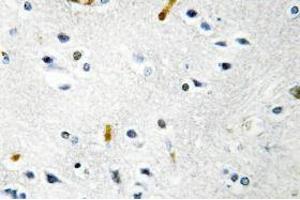 Image no. 1 for anti-TPX2, Microtubule-Associated, Homolog (Xenopus Laevis) (TPX2) antibody (ABIN317807) (TPX2 抗体)