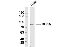 Hela lysates probed with DGKA Polyclonal Antibody, Unconjugated  at 1:300 dilution and 4˚C overnight incubation. (DGKA 抗体  (AA 201-300))