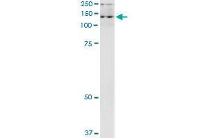 Immunoprecipitation of ADAR transfected lysate using anti-ADAR MaxPab rabbit polyclonal antibody and Protein A Magnetic Bead , and immunoblotted with ADAR purified MaxPab mouse polyclonal antibody (B01P) . (ADAR 抗体  (AA 1-1226))