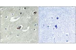 Immunohistochemistry (IHC) image for anti-Kinesin Family Member 20A (KIF20A) (AA 501-550) antibody (ABIN2888893) (KIF20A 抗体  (AA 501-550))
