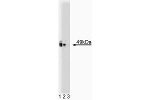 Western blot analysis of PKA [RIalpha] on a rat cerebrum lysate. (PKA R1 alpha (PKR1) (AA 1-381) 抗体)