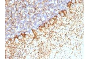 Formalin-fixed, paraffin-embedded rat cerebellum stained with Neurofilament antibody (RT-97 + NR-4). (Neurofilament 抗体)