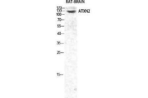 Western Blot (WB) analysis of specific cells using Ataxin-2 Polyclonal Antibody. (Ataxin 2 抗体  (Internal Region))