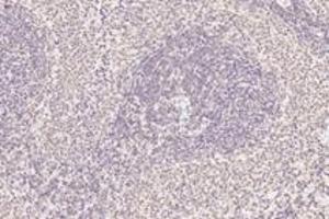 Immunohistochemistry (Paraffin-embedded Sections) (IHC (p)) image for anti-Acidic (Leucine-Rich) Nuclear phosphoprotein 32 Family, Member B (ANP32B) antibody (ABIN7072887)