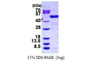 Image no. 1 for rho GDP Dissociation Inhibitor (GDI) beta (ARHGDIB) protein (GST tag) (ABIN6386923) (ARHGDIB Protein (GST tag))