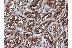 Image no. 7 for anti-Rhotekin (RTKN) antibody (ABIN1500702)