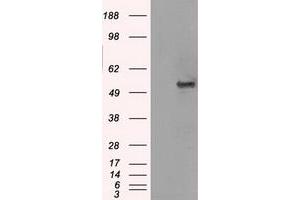 Image no. 1 for anti-Solute Carrier Family 2 (Facilitated Glucose/fructose Transporter), Member 5 (SLC2A5) antibody (ABIN1498473) (SLC2A5 抗体)