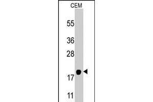 Western blot analysis of PPBP polyclonal antibody  in CEM cell line lysates (35 ug/lane). (CXCL7 抗体  (AA 99-128))