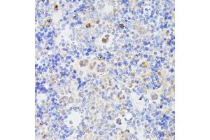 Immunohistochemistry of paraffin-embedded mouse spleen using MLF2 antibody (ABIN7268725) at dilution of 1:100 (40x lens). (MLF2 抗体  (AA 1-65))