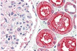 Human Kidney (formalin-fixed, paraffin-embedded) stained with ACE2 antibody ABIN461888 at 2. (ACE2 抗体  (Internal Region))
