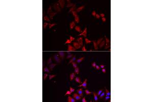 Immunofluorescence analysis of U2OS cells using PCBD1 antibody. (PCBD1 抗体)