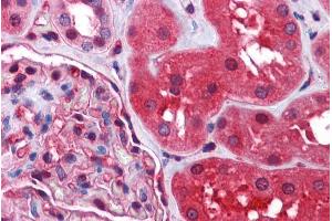 Immunohistochemistry (IHC) image for anti-Radixin (RDX) (Internal Region) antibody (ABIN185665)
